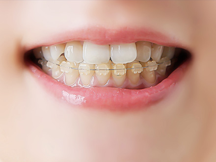 審美歯科・自費診療